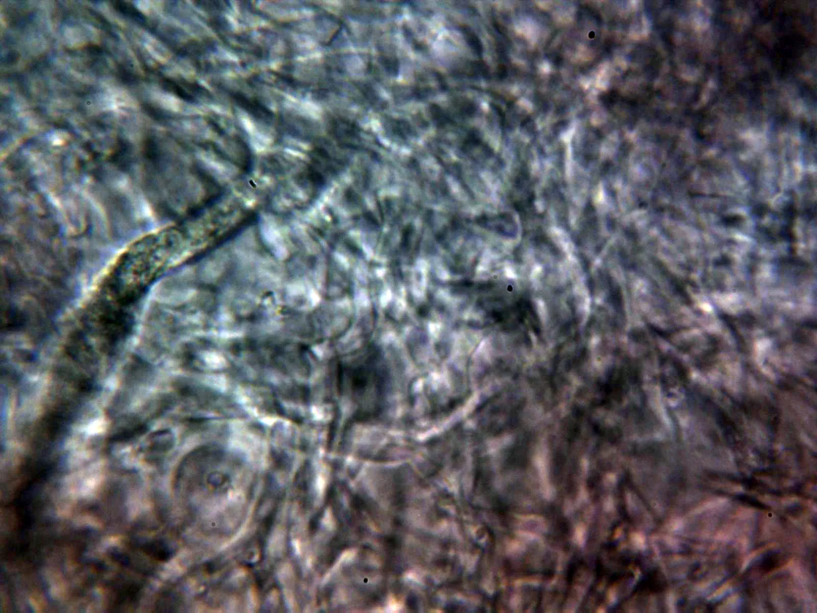 Microscopía de Russula citrinochlora - 10 -  Pileipellis